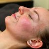 curso acupuntura facial